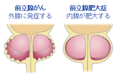 私の近くの勃起不全